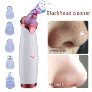 ELECTRIC BLACKHEAD ACNE REMOVER