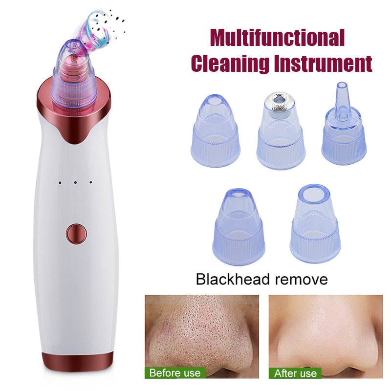 ELECTRIC BLACKHEAD ACNE REMOVER